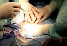 Nemocnice omezují plánované výkony. Tzn. zásah do úhrad plánované výkony