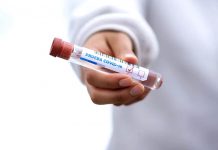 I dobrovolné covid testy u zaměstnanců jsou daňově uznatelné covid testy